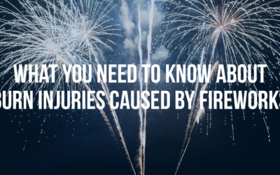 What You Need To Know About Injuries Caused By Fireworks - Mukerji Law