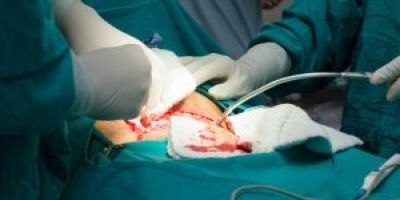 5 Crazy Medical Malpractice Court Cases - Mukerji Law